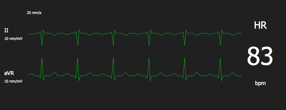 心电图怎么切换导联你了解过心电图导联吗？_https://www.jmylbn.com_新闻资讯_第1张