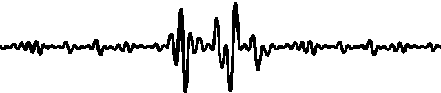 宫颈光是什么意思光动力——让宫颈上皮内瘤变在“光”下无处遁形_https://www.jmylbn.com_新闻资讯_第46张