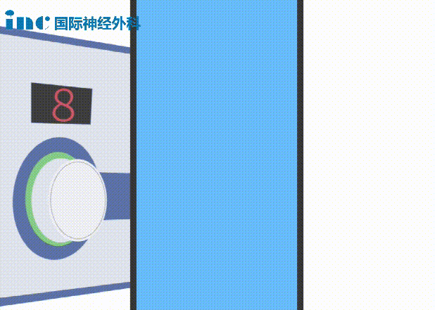 双极电凝为什么要冲水神外科普系列｜2分钟动画解读：什么是双极电凝？有什么作用？_https://www.jmylbn.com_新闻资讯_第5张