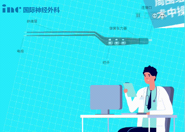 双极电凝为什么要冲水神外科普系列｜2分钟动画解读：什么是双极电凝？有什么作用？_https://www.jmylbn.com_新闻资讯_第6张