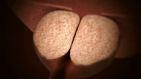 上海什么无影灯好专访和睦家医疗上海地区泌尿外科首席专家齐隽：手术机器人时代，探寻更好的答案_https://www.jmylbn.com_新闻资讯_第9张