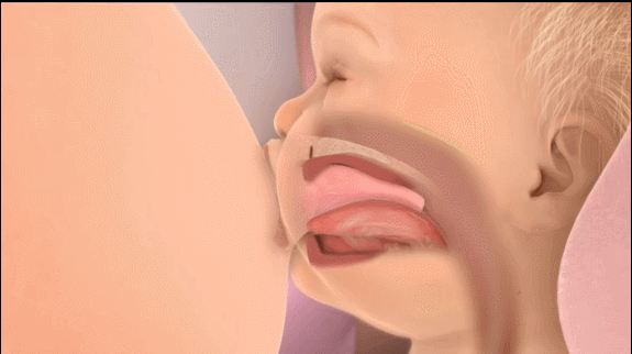 激光和电刀区别是什么为什么要剪舌系带？_https://www.jmylbn.com_新闻资讯_第15张