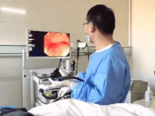 奥林巴斯胃肠镜怎么做消化内镜中心：奥林巴斯290电子胃肠镜系统投用，开启诊疗新“镜”界_https://www.jmylbn.com_新闻资讯_第11张