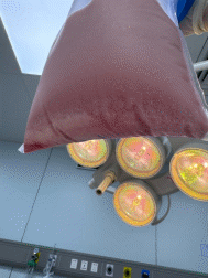 图：膝关节针刀镜术中冲洗液