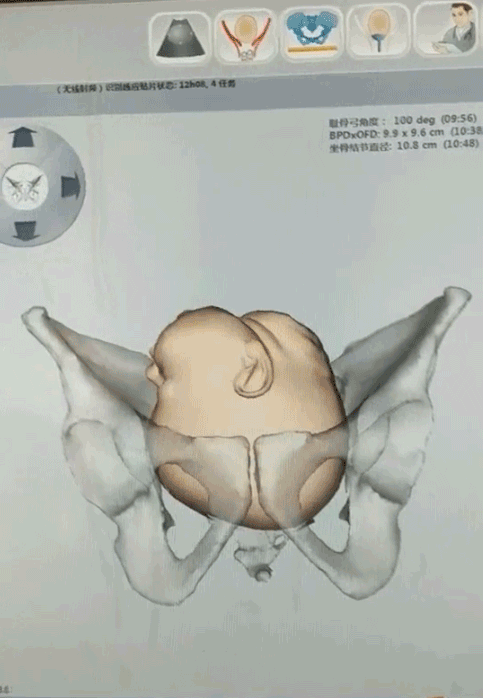 产程三维导航是什么分娩有导航，顺产不慌张 ｜ 张店区妇幼保健院护产神器LaborPro为准妈妈们保驾护航_https://www.jmylbn.com_新闻资讯_第4张