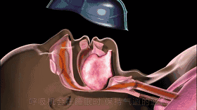 怎么备呼吸机ICU必备工具：呼吸机的使用你知多少_https://www.jmylbn.com_新闻资讯_第2张