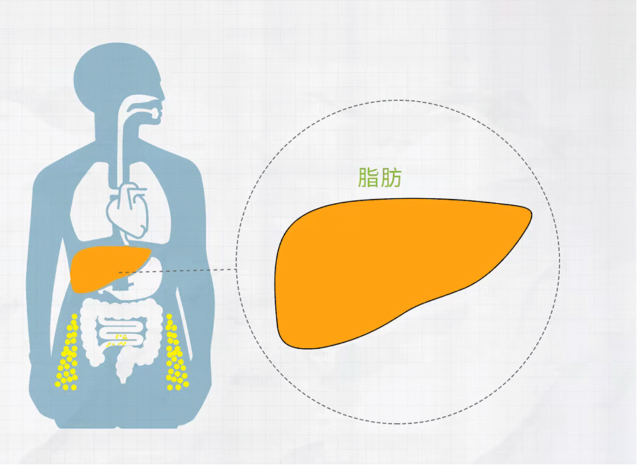 【健康】這種「痣」可能是肝病信號！8件事正悄悄威脅你的肝→ 健康 第7張