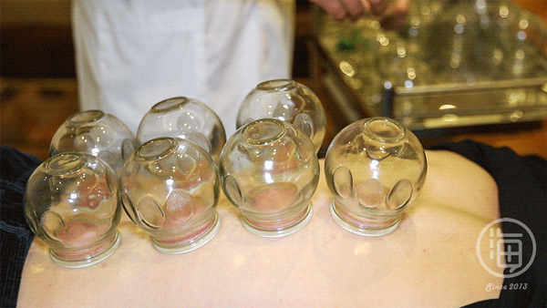 医生自述三级医院真实见闻:拔火罐引发的人间悲剧……_医学界-助力