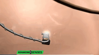 9.gif