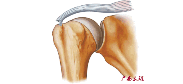 肩关节MRI解剖肩袖损伤诊断技巧--对应动图，效果超赞