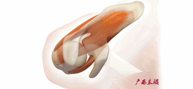 肩关节MRI解剖肩袖损伤诊断技巧--对应动图，效果超赞