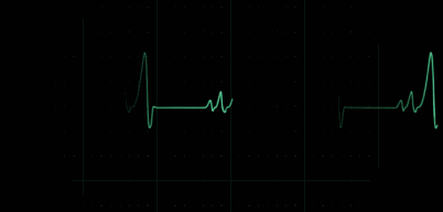 养狗的几大误区，你中了哪条？