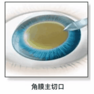 汕头博德眼科医院