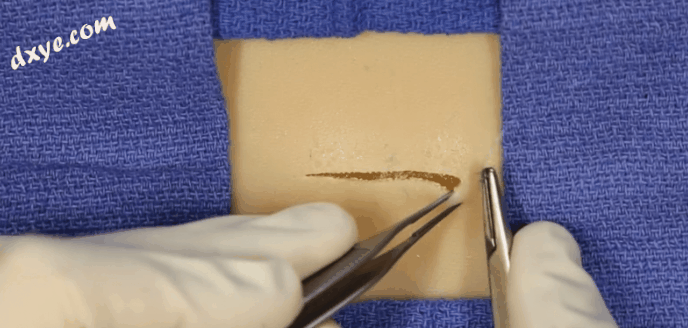 皮下缝合用什么线皮下缝合_https://www.jmylbn.com_新闻资讯_第1张