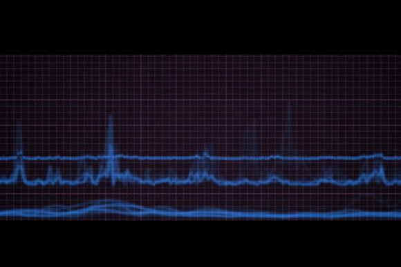 动态心电图接头怎么接1份动态心电图报告单，10分钟生命接力_https://www.jmylbn.com_新闻资讯_第5张