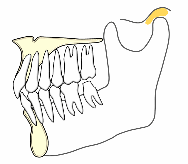 咬合记录的对与错