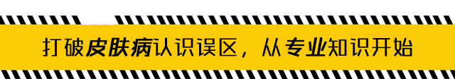 治疗头癣又快又好的治疗方法