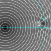 向穴位输入能量，为何也能治病？-人的解读