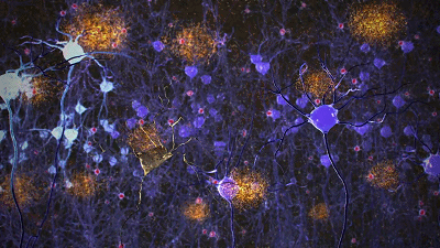 恢复特定的节律之后,β淀粉样蛋白开始消失