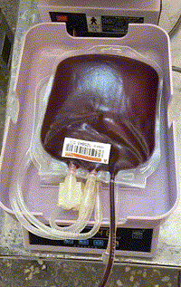 为什么一次性压脉带科普知识｜为你解答献血过程的一些疑问_https://www.jmylbn.com_新闻资讯_第4张