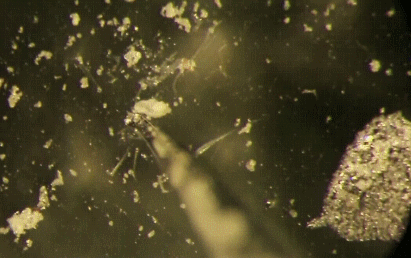 能肉眼螨虫看到的东西_螨虫肉眼能看到吗_能肉眼螨虫看到吗