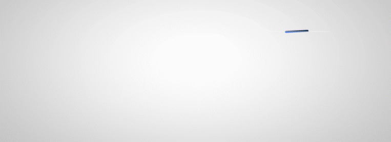 什么是定位放疗放疗前的CT模拟定位是什么？您清楚吗？_https://www.jmylbn.com_新闻资讯_第1张