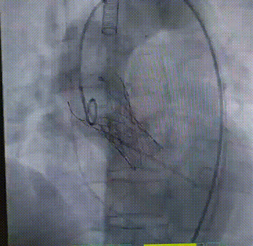 640_wx_fmt=gif&from=appmsg&tp=webp&wxfrom=10005&wx_lazy=1 (1).gif