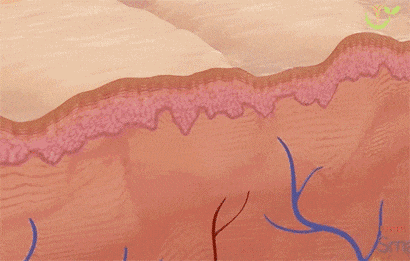 点阵激光后冷敷怎么敷市二院科普丨点阵激光：能让皮肤光滑如刚剥的鸡蛋？_https://www.jmylbn.com_新闻资讯_第7张