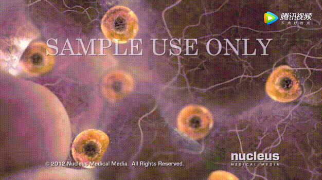 取卵针长什么样试管婴儿取卵的针有这么长长长的嘛？听说有人疼的打滚？_https://www.jmylbn.com_新闻资讯_第14张