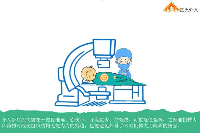 去医院看病内科外科还是介入