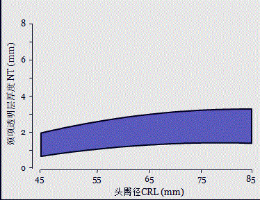 胎儿mt是什么检查什么疼吗【专题讲座】11-13周的超声检查（3）-染色体异常筛查-颈项透明层、胎儿心率_https://www.jmylbn.com_新闻资讯_第7张
