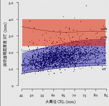 胎儿mt是什么检查什么疼吗【专题讲座】11-13周的超声检查（3）-染色体异常筛查-颈项透明层、胎儿心率_https://www.jmylbn.com_新闻资讯_第14张