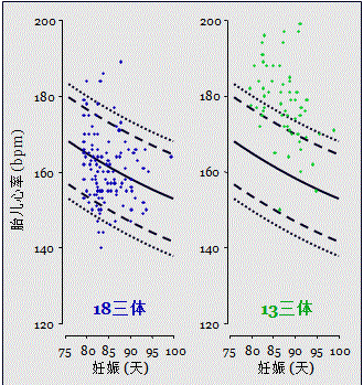 胎儿mt是什么检查什么疼吗【专题讲座】11-13周的超声检查（3）-染色体异常筛查-颈项透明层、胎儿心率_https://www.jmylbn.com_新闻资讯_第17张