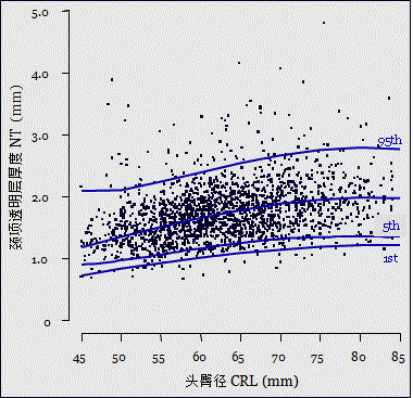 胎儿mt是什么检查什么疼吗【专题讲座】11-13周的超声检查（3）-染色体异常筛查-颈项透明层、胎儿心率_https://www.jmylbn.com_新闻资讯_第13张