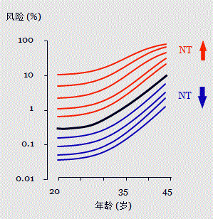 胎儿mt是什么检查什么疼吗【专题讲座】11-13周的超声检查（3）-染色体异常筛查-颈项透明层、胎儿心率_https://www.jmylbn.com_新闻资讯_第11张