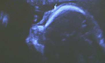 汕头彩超怎么样不再抓瞎！一篇文章带你读懂孕期排畸检查，看完记得收藏 ｜ 汕头妇产科医院_https://www.jmylbn.com_新闻资讯_第15张