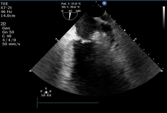 彩超伪像是什么心脏超声伪像有哪些？如何识别它们？_https://www.jmylbn.com_新闻资讯_第40张