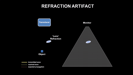 彩超伪像是什么心脏超声伪像有哪些？如何识别它们？_https://www.jmylbn.com_新闻资讯_第15张