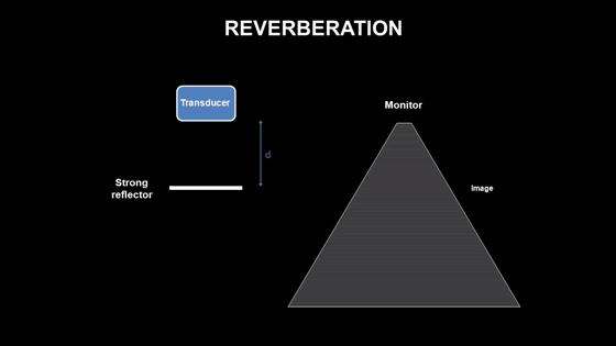 彩超伪像是什么心脏超声伪像有哪些？如何识别它们？_https://www.jmylbn.com_新闻资讯_第6张