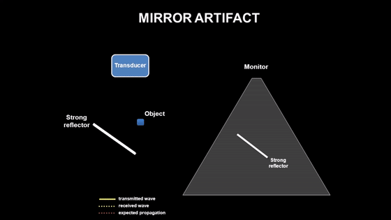 彩超伪像是什么心脏超声伪像有哪些？如何识别它们？_https://www.jmylbn.com_新闻资讯_第11张