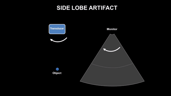 彩超伪像是什么心脏超声伪像有哪些？如何识别它们？_https://www.jmylbn.com_新闻资讯_第19张