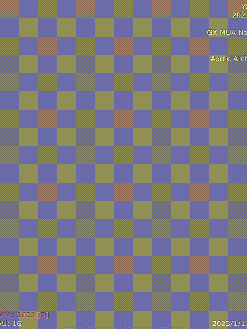 gore医疗怎么样「胸有乾坤」化险为夷，通险畅机——GORE® TAG® 胸主动脉覆膜支架治疗累及异形弓部动脉瘤_https://www.jmylbn.com_新闻资讯_第15张