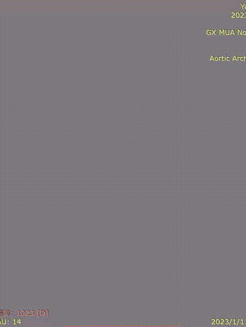 gore医疗怎么样「胸有乾坤」化险为夷，通险畅机——GORE® TAG® 胸主动脉覆膜支架治疗累及异形弓部动脉瘤_https://www.jmylbn.com_新闻资讯_第14张