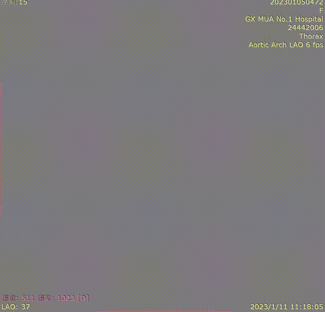 gore医疗怎么样「胸有乾坤」化险为夷，通险畅机——GORE® TAG® 胸主动脉覆膜支架治疗累及异形弓部动脉瘤_https://www.jmylbn.com_新闻资讯_第19张