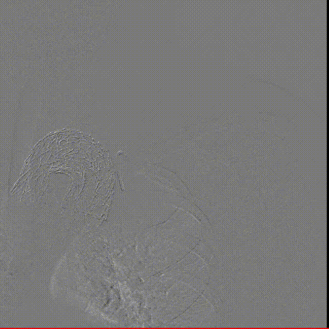 gore医疗怎么样「胸有乾坤」化险为夷，通险畅机——GORE® TAG® 胸主动脉覆膜支架治疗累及异形弓部动脉瘤_https://www.jmylbn.com_新闻资讯_第26张