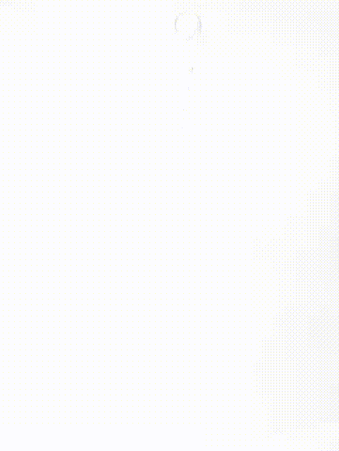 gore医疗怎么样「胸有乾坤」释半功倍 得心应手——GORE®TAG® 可主动调控胸主动脉覆膜支架治疗B型主动脉夹层病例分享 复旦大学附属中山医院_https://www.jmylbn.com_新闻资讯_第8张