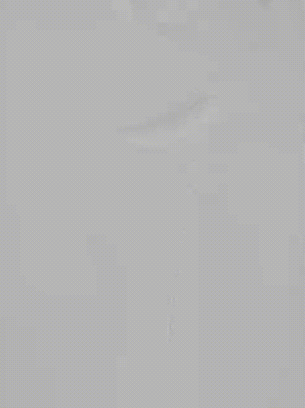 gore医疗怎么样「胸有乾坤」释半功倍 得心应手——GORE®TAG® 可主动调控胸主动脉覆膜支架治疗B型主动脉夹层病例分享 复旦大学附属中山医院_https://www.jmylbn.com_新闻资讯_第9张