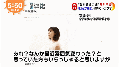 她一直活在明星妹妹的阴影下靠整形改变人生 组图 1 新闻网
