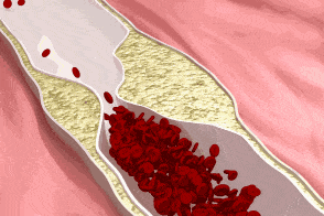 什么是血液净化？这4大征兆提示你的“血液垃圾”已过载！