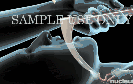 什么是有创呼吸机图片呼吸机 ——ICU救命神器介绍_https://www.jmylbn.com_新闻资讯_第4张